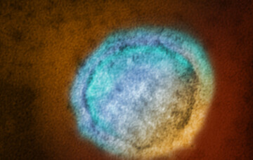 Nipah Virus: What You Need to Know Before Travelling in Asia